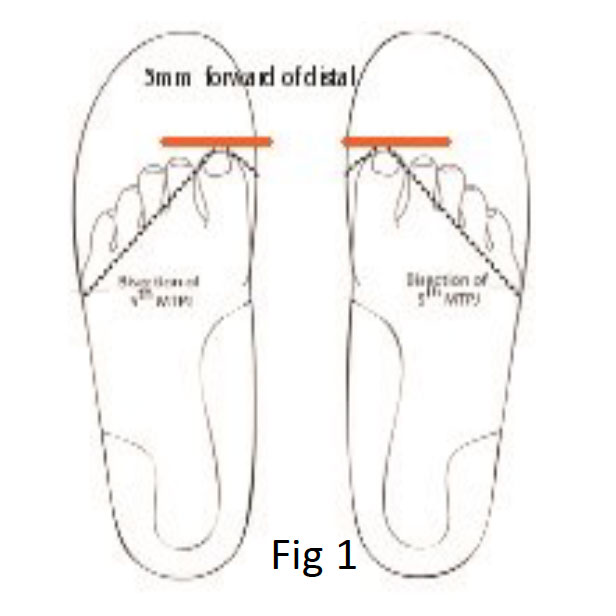 June, 2019 | DLT Podiatry